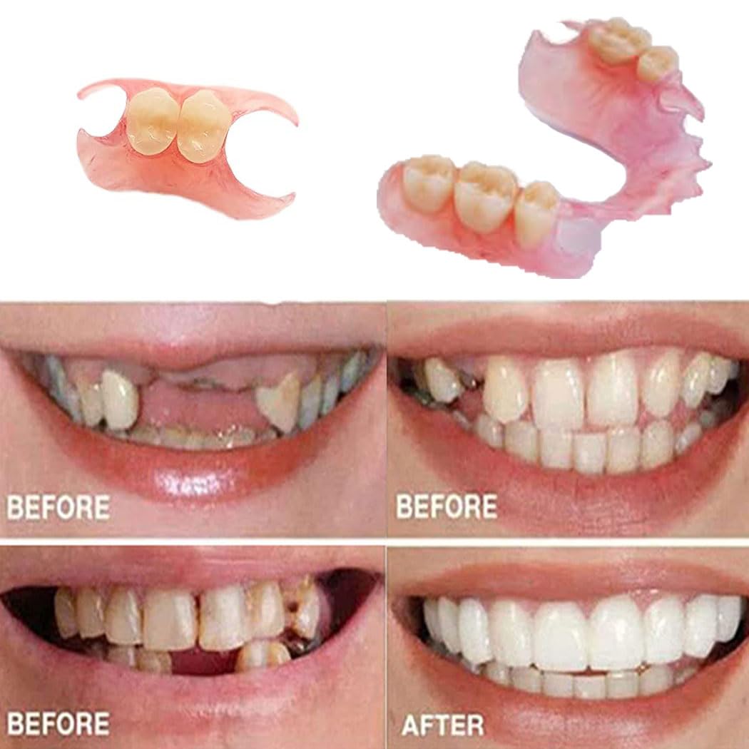 Fake Tooth Repair Kit Q285